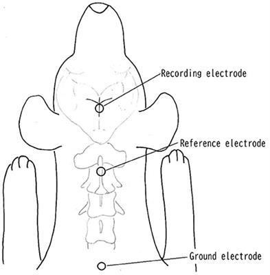 Somatosensory evoked potentials of the tibial nerve during the surgical decompression of thoracolumbar intervertebral disk herniation in dogs